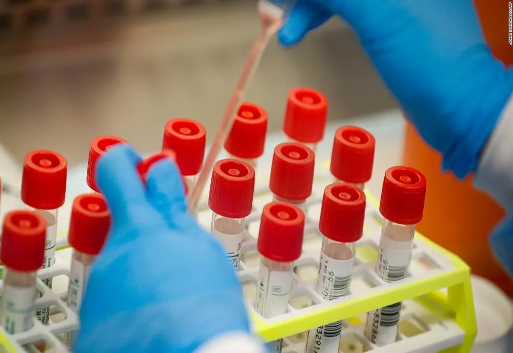 Încă 4 harghiteni infectaţi. 164 persoane confirmate cu noul coronavirus