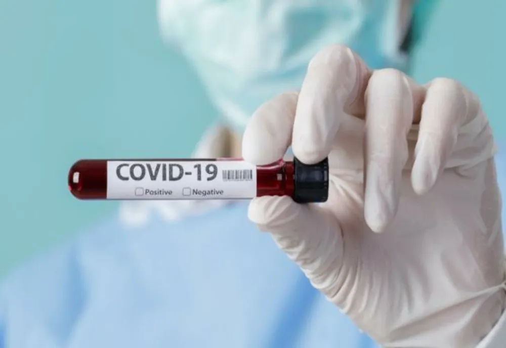 Bilanț COVID pentru ultimele 24 de ore:  1.391 de cazuri noi și 35 de decese/ 478 dintre infectați se află pe secțiile ATI