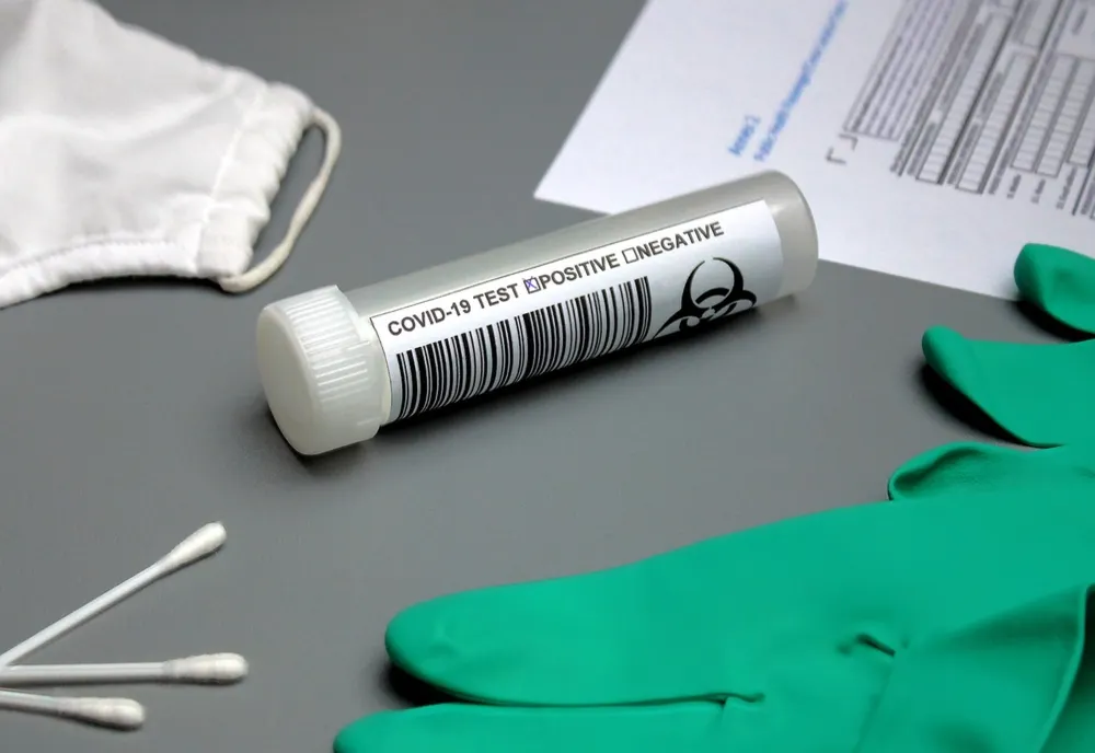 Bilanț coronavirus 21 decembrie: 826 de cazuri noi și 88 decese dintre care 22 anterioare