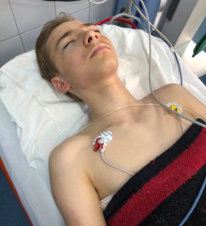 FOTO Fiul preşedintelui Federaţiei Române de Ciclism, Eduard Novak, lovit de maşină