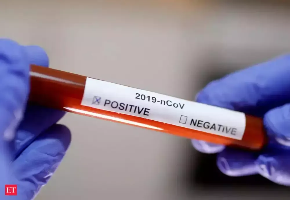 Judeţul Harghita rămâne "blocat" la 19 cazuri de coronavirus. Cifra nu a mai fost actualizată de luni