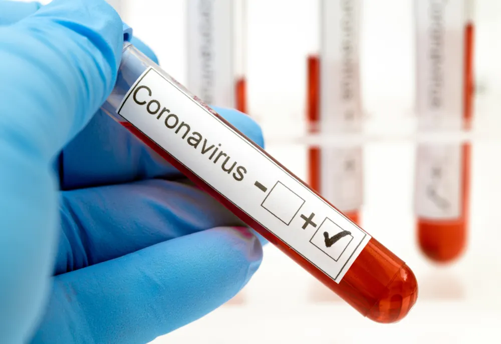 Încă doi harghiteni testaţi pozitiv pentru Covid-19. Bilanţul a ajuns la 117 persoane infectate