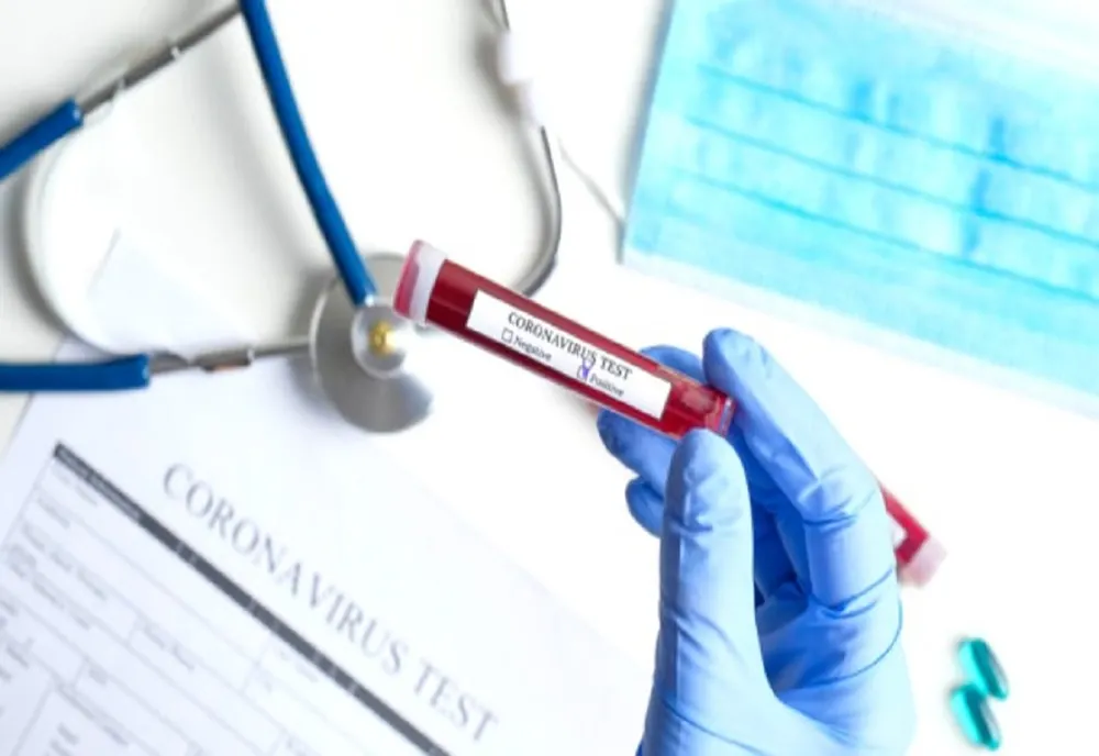 ANALIZĂ. Cea mai neagră săptămână de la începutul epidemiei în România – 19.383 de cazuri în ultimele șapte zile