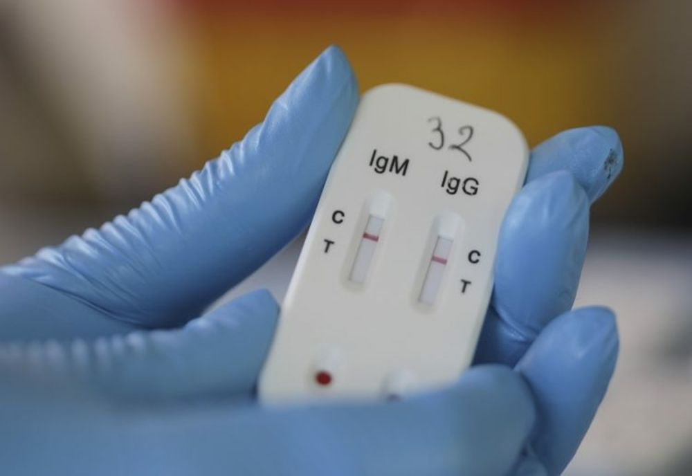 Teste gratuite COVID-19 la 106 farmacii din țară