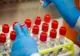 Încă 4 harghiteni infectaţi. 164 persoane confirmate cu noul coronavirus