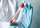 270 de cazuri de COVID-19. Încă 8 harghiteni infectați