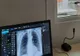 Pacienții cu Covid-19 care nu au nevoie de spitalizare sunt consultați doar pe bază de programare